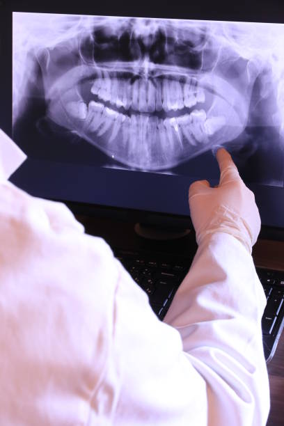 Best Knocked-Out Tooth (Avulsed Tooth) Treatment in Mullins, SC