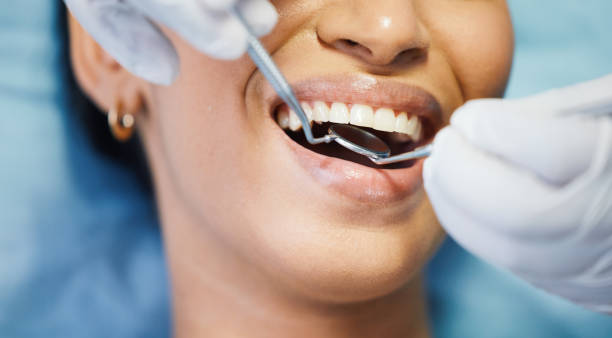 Best Emergency Wisdom Tooth Extraction in Mullins, SC